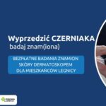 Legnica walczy z czerniakiem. Zapisz się na bezpłatne badania