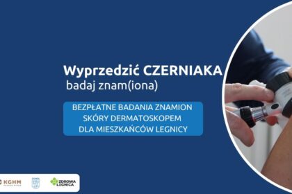 Legnica walczy z czerniakiem. Zapisz się na bezpłatne badania