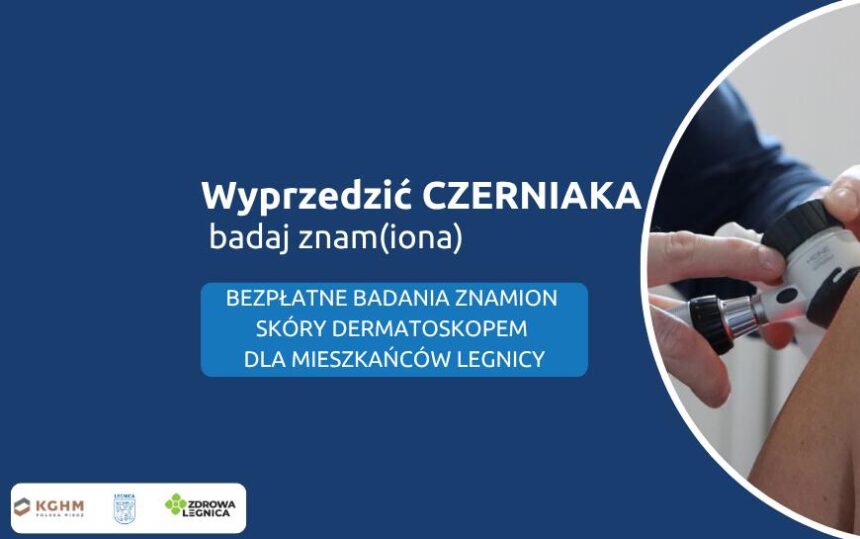Legnica walczy z czerniakiem. Zapisz się na bezpłatne badania